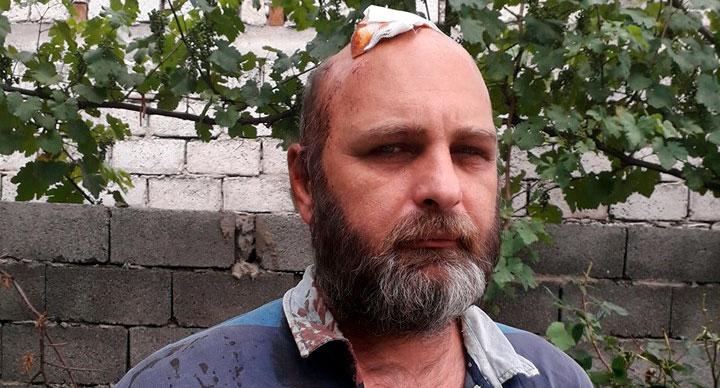 Беслан Кмузов после ранения во время акции протеста в Тбилиси. Фото Ния Хубуная для "Кавказского узла" Беслан Кмузов после ранения во время акции протеста в Тбилиси. Фото Ния Хубуная для "Кавказского узла"