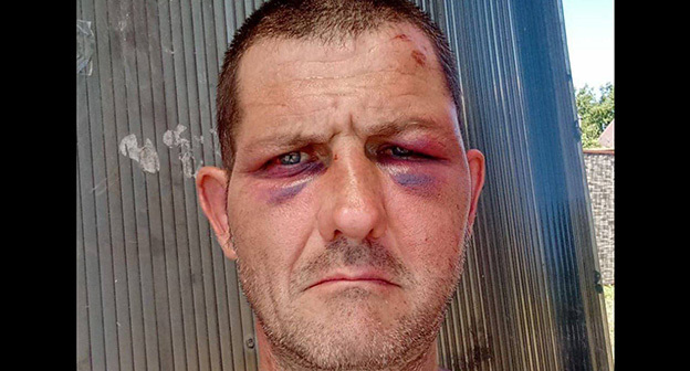 Избиение жителя Краснодарского края Федора Валько. Фото: https://t.me/no_torture/3590